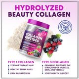 Collagen Peptides Powder 20g - Hydrolyzed Type 1 & 3 Berry Flavor Collagen Powder - Biotin, Hyaluronic Acid, Vitamin C - Hair, Skin, & Nails Support Supplement for Women & Men - Bottled in USA, 10.5oz